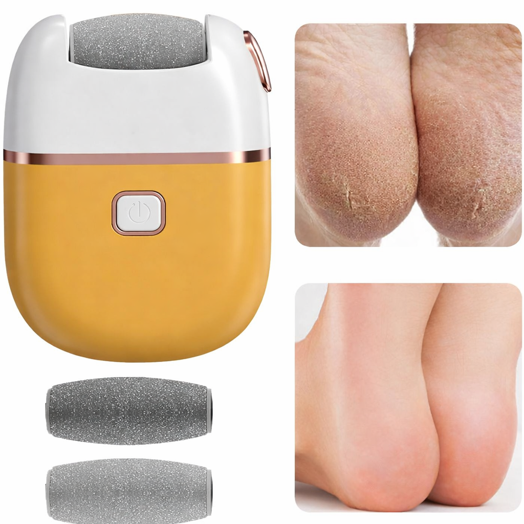 Lima de Callos Inalámbrico