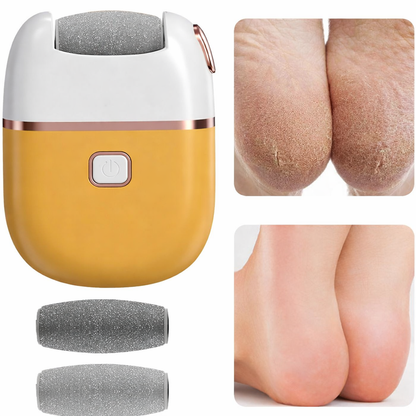 Lima de Callos Inalámbrico